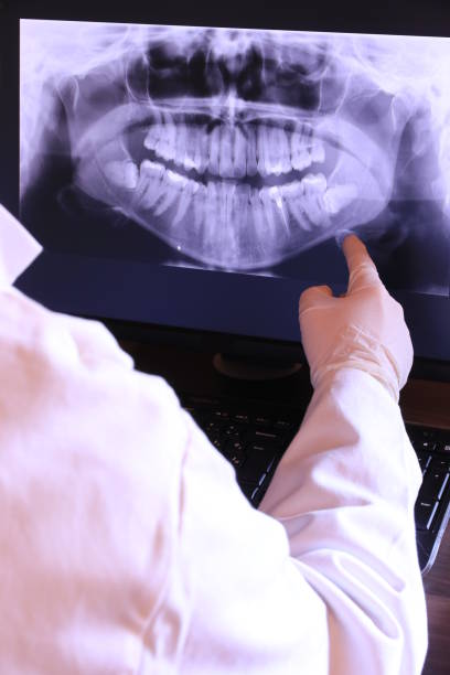 Best Dentist for Tooth Abscess  in Jeffersonville, KY